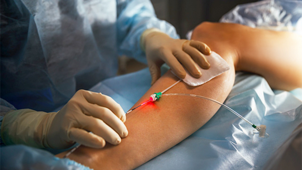 Сосудистые хирурги