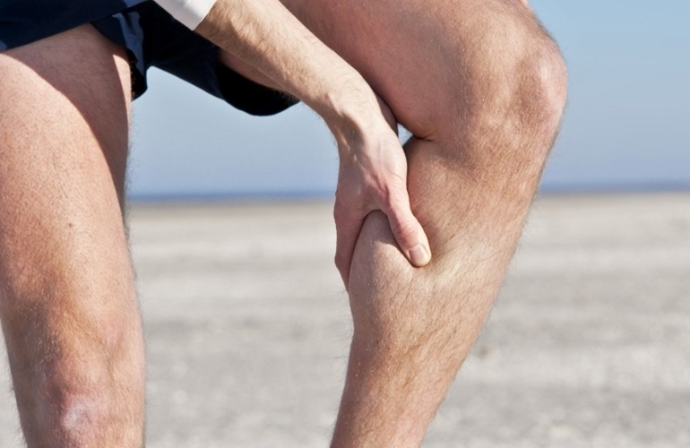 Варикоз у мужчин