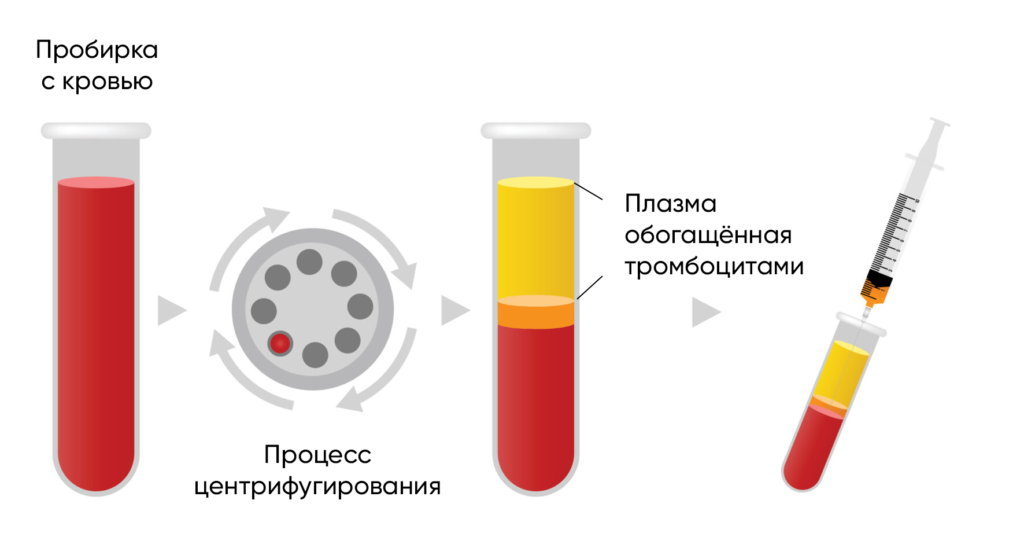 Подготовка плазмы