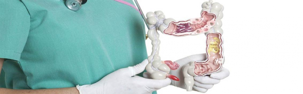 Проведение аноскопического осмотра