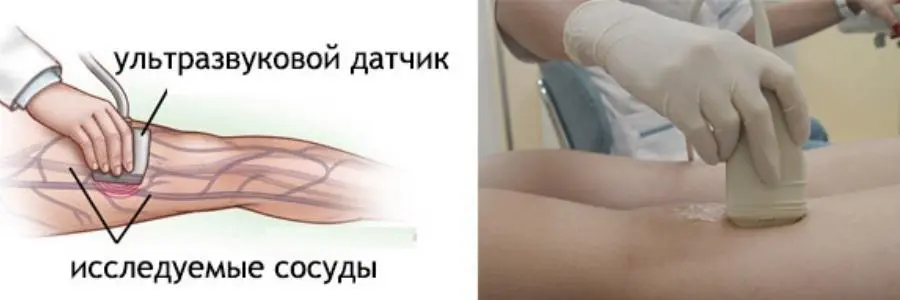 Процедура УЗДГ