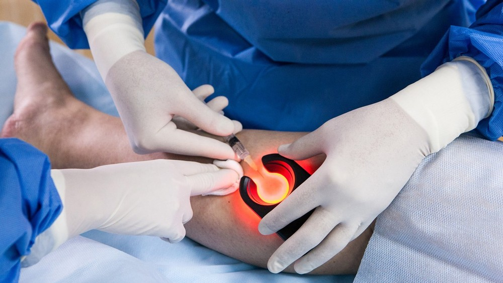 Сосудистая хирургия