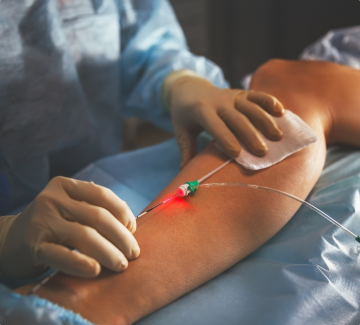 Процедура ТОТАЛ ЭВЛК