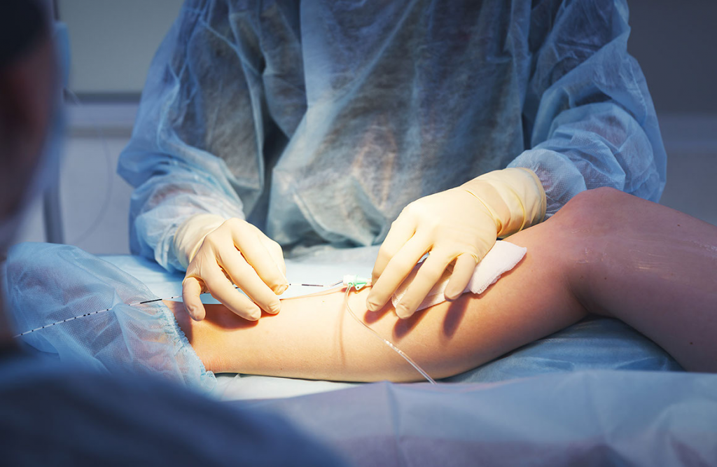 Профилактика варикоза: клинические методы