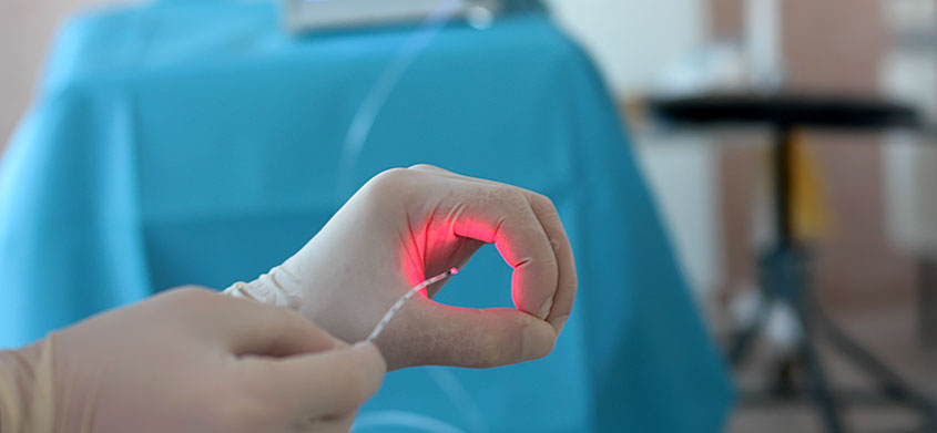 Лазерная тромбэктомия