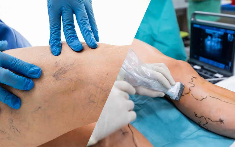 Прием ангиохирурга