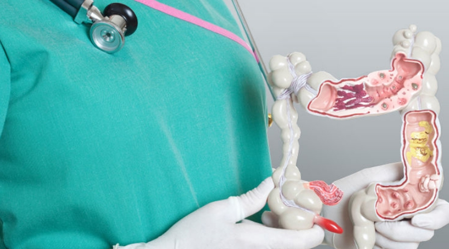 Тромбоз геморроидального узла