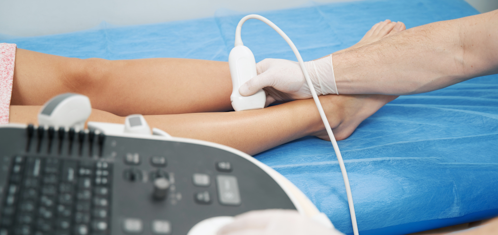 УЗДГ нижних конечностей