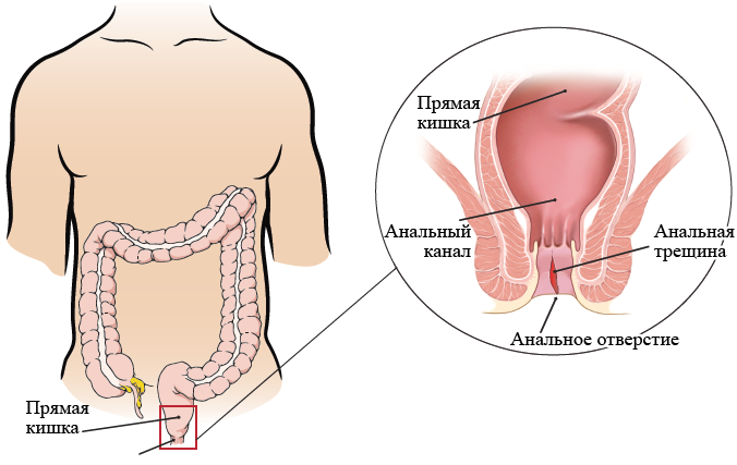 Показания и противопоказания к плазмолифтингу