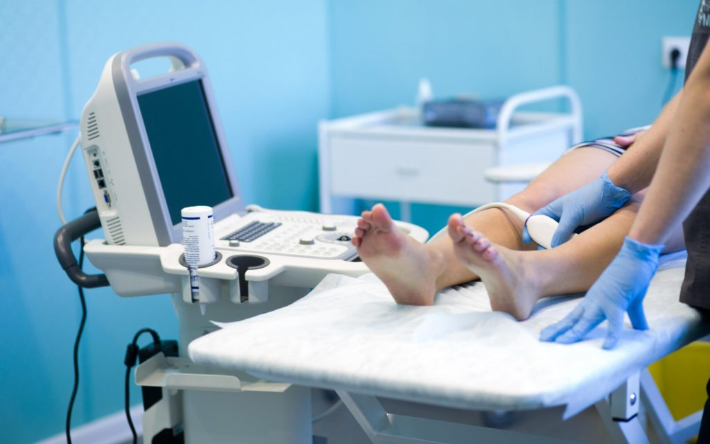 УЗИ вен